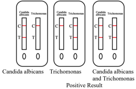 Result Interpretation1